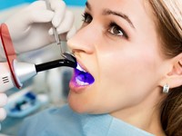 Blanqueamiento dental, todo lo que necesita saber