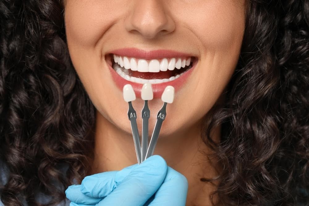 ¿Qué es una corona dental?