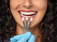 ¿Qué es una corona dental?